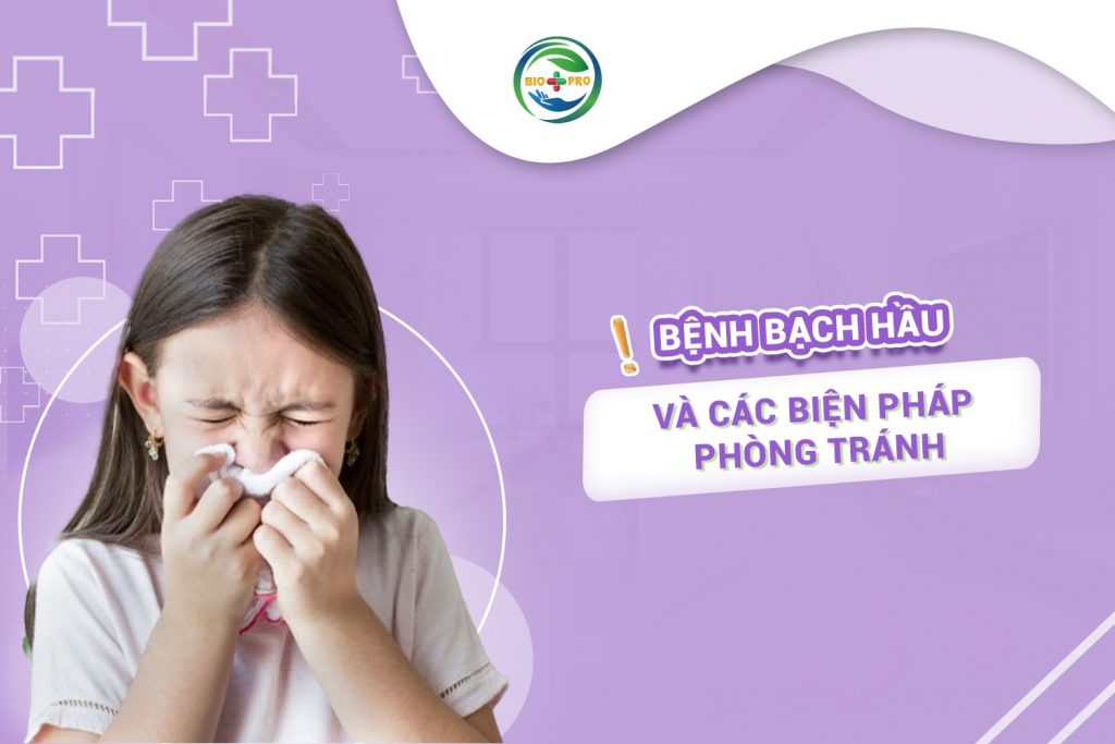 Bệnh bạch hầu và các biện pháp phòng tránh