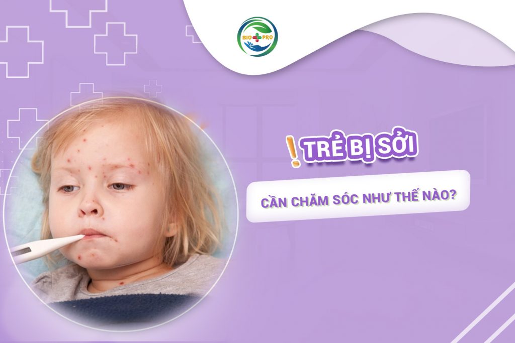 Trẻ bị sởi cần chăm sóc như thế nào?