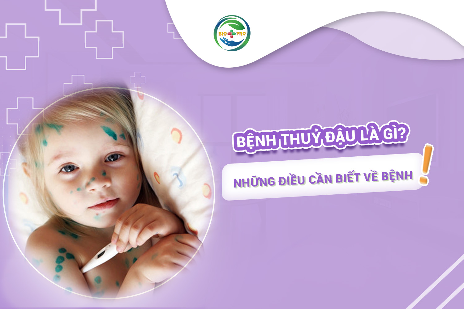 Bệnh thuỷ đậu là gì? Những điều cần biết về bệnh