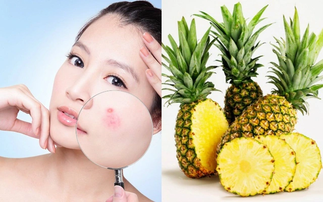 Ăn dứa có tác dụng gì? 7 lợi ích sức khỏe tuyệt vời của quả dứa Ăn dứa thường xuyên sẽ giúp làm đều màu da và chống lại quá trình lão hóa tự nhiên