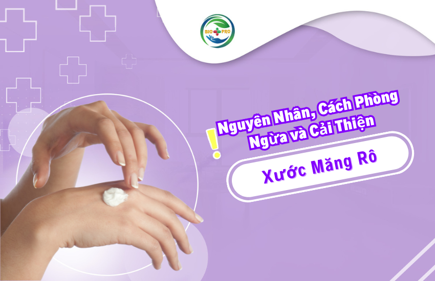 Avatar web Xuoc mang ro